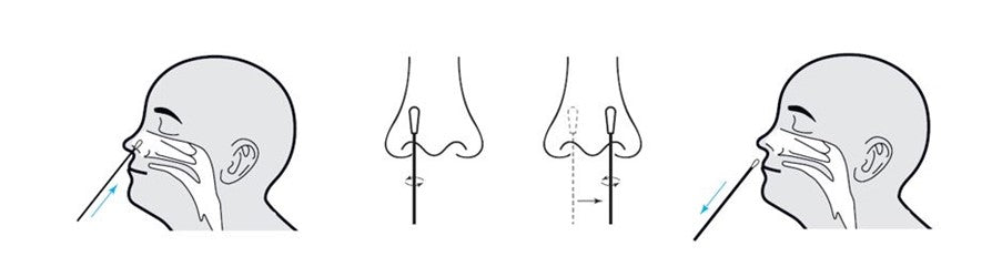 Healgen ANITGEN RAPID / Lateral Flow Test Kits